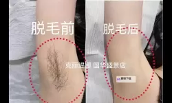 永久脱毛网：解锁肌肤光滑的现代美学之旅